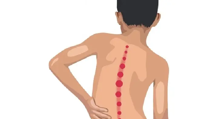 kelainan pada sistem gerak manusia