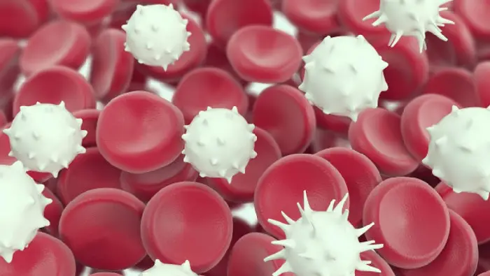 penyebab darah putih tinggi